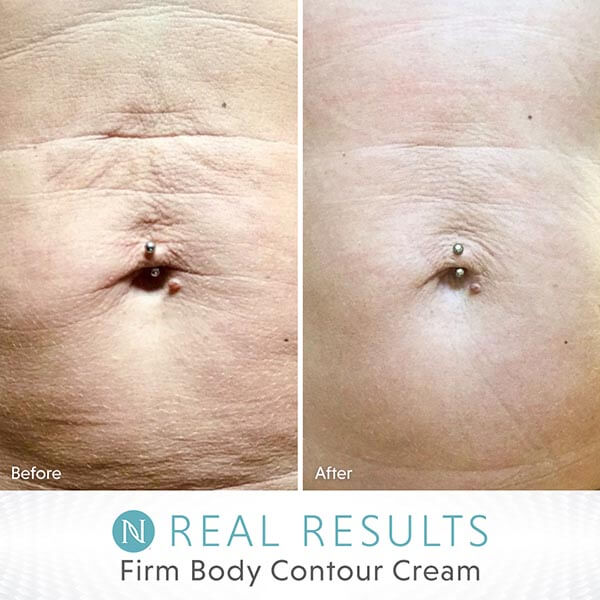 person's stomach before and after using Neora Firm Body Contour Cream